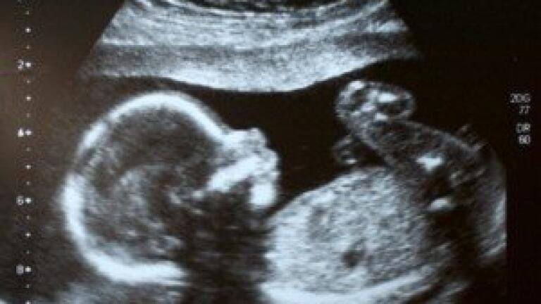 Non-invasive approach to obtaining fetal genome developed in lab