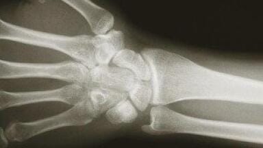 Human bones grown in laboratory