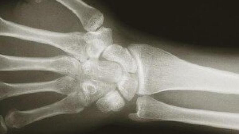 Human bones grown in laboratory