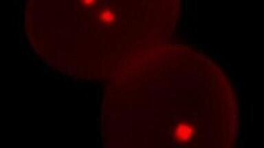 Researchers investigate best microscope techniques for pollen grain study