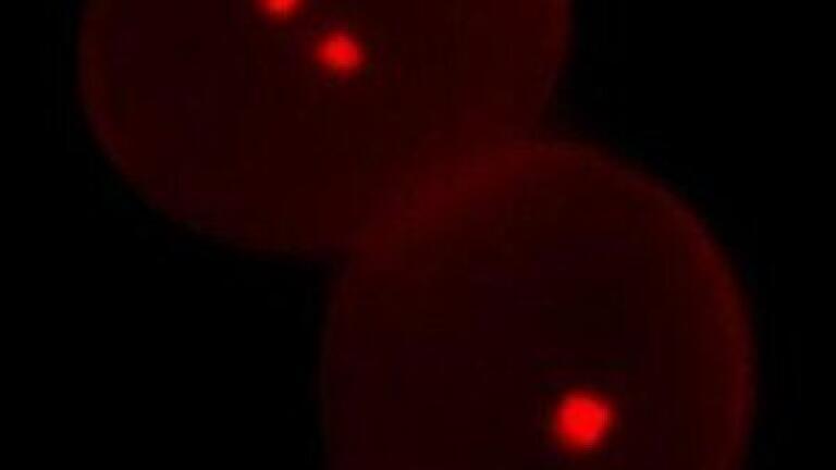 Researchers investigate best microscope techniques for pollen grain study