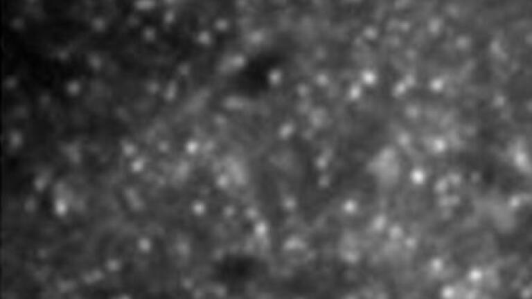 Pic 2.  OCTOPUS reveal discrete single molecules in plant. Small particles are observed with a totalinternal reflection fluorescence microscope (TIRFM) - invisible with standard confocal microscopy.
(Credit: Dr John Runions, Oxford Brookes University) 
