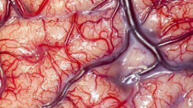 Human brain photo takes Wellcome Image Awards topspot  