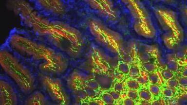 Further Secondary Antibody Conjugates Offered