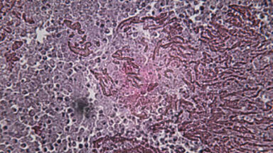 TB research programme to assess new drug combinations
