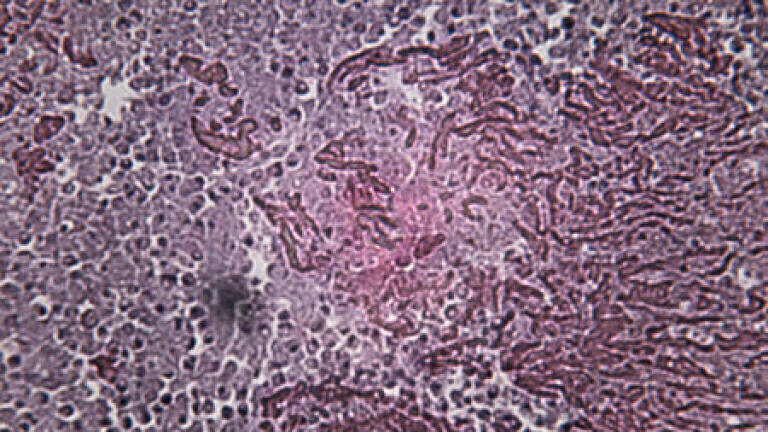 TB research programme to assess new drug combinations