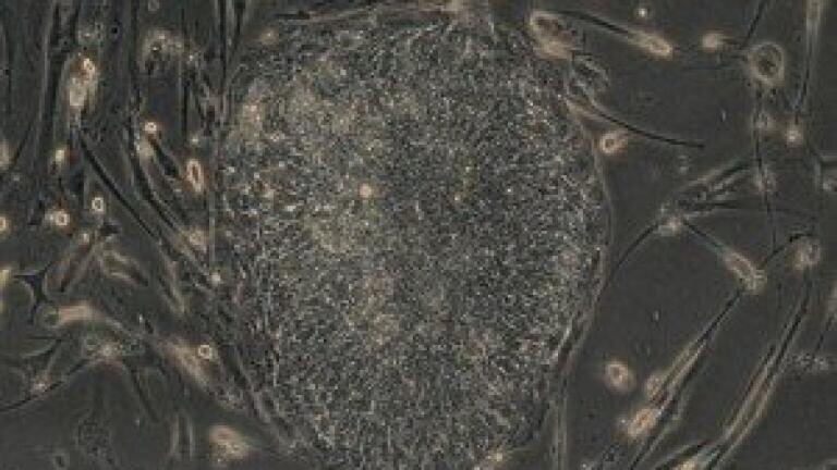 Similarities found between cancer cells and induced pluripotent stem cells, say researchers