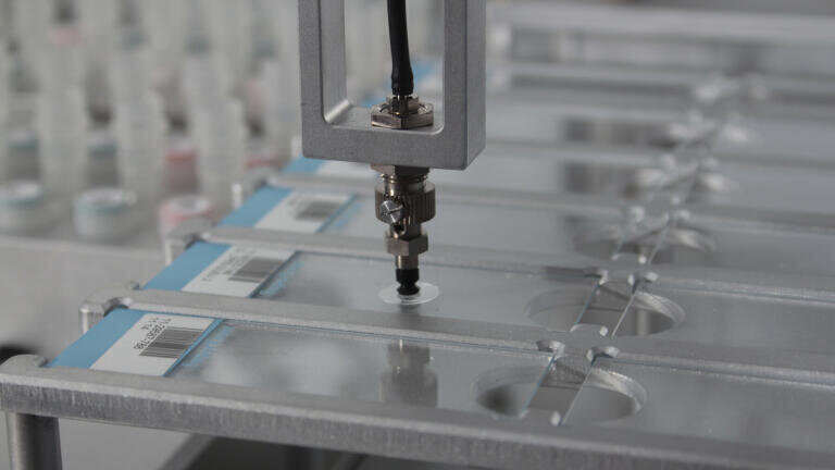 Automated Fluorescence In Situ Hybridisation