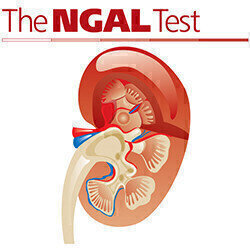 Rapid Test Provides Earlier Detection of Acute Kidney Injury