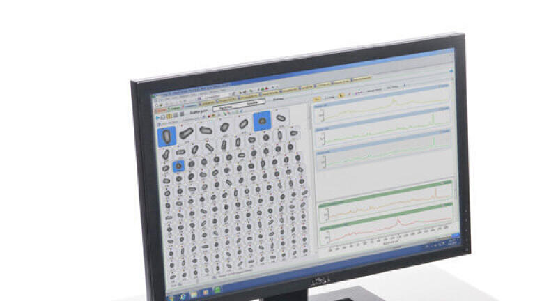 Launch of new Imaging Masterclass Webinar Series