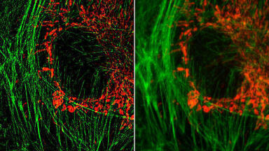 Strathclyde playing a crucial role in microscope revolution    