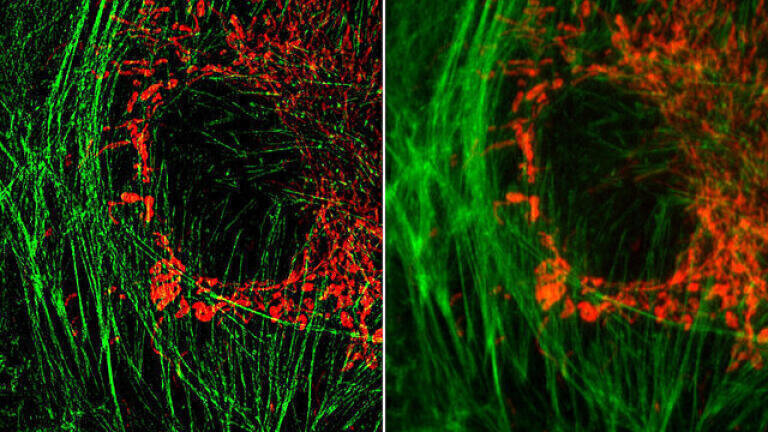 Strathclyde playing a crucial role in microscope revolution    