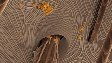 Spider Skin Image Captures Grand PrizFEI Image Contest    