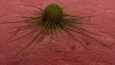 New screening process could detect ovarian tumours early