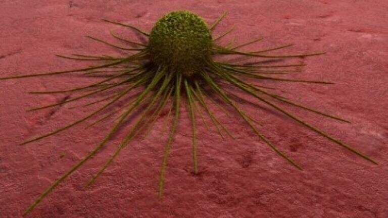 New screening process could detect ovarian tumours early
