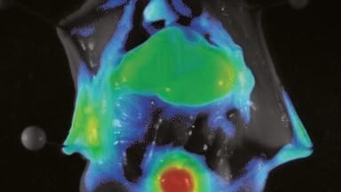 Near Infrared Dye Distribution in a Nude Mouse