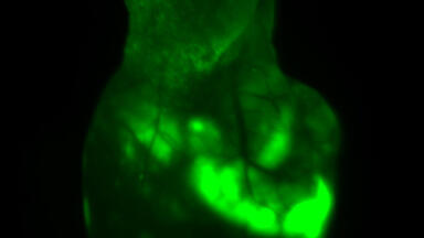 In Vivo Fluorescence Imaging of Angiogenic Vessels in Liver Cancer Animal Model