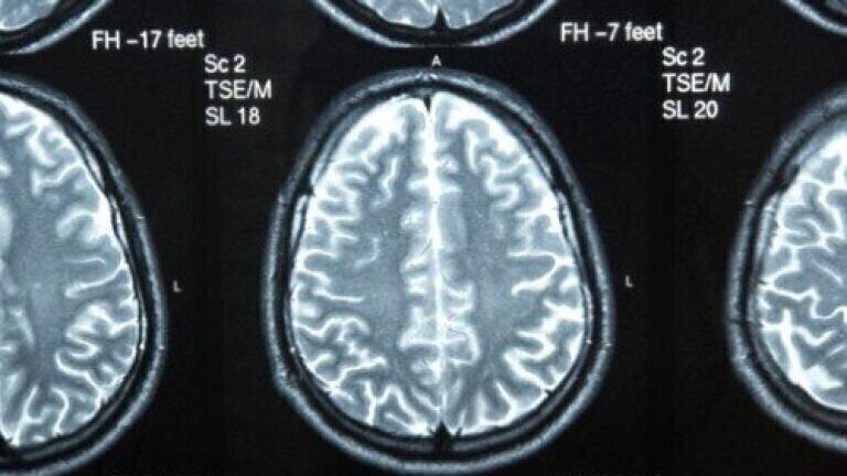 New drug proves effective at brain cancer treatment