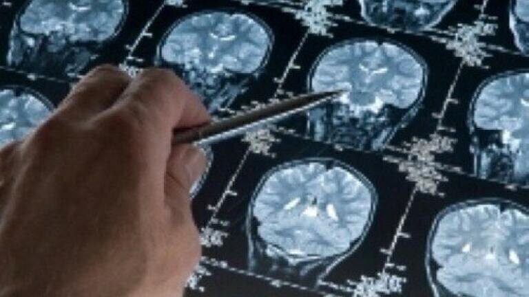 30-minute brain cancer test developed