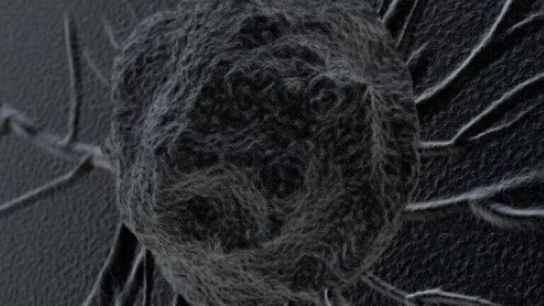 'Sticky balls' could help stop spread of cancer