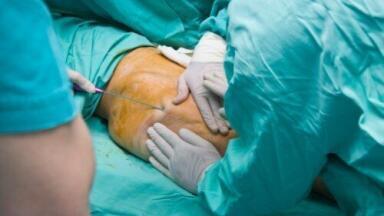 UK sees rise in plastic surgery uptake