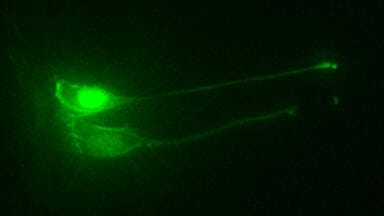 Researchers Uncover Secrets of Newborn Neurons