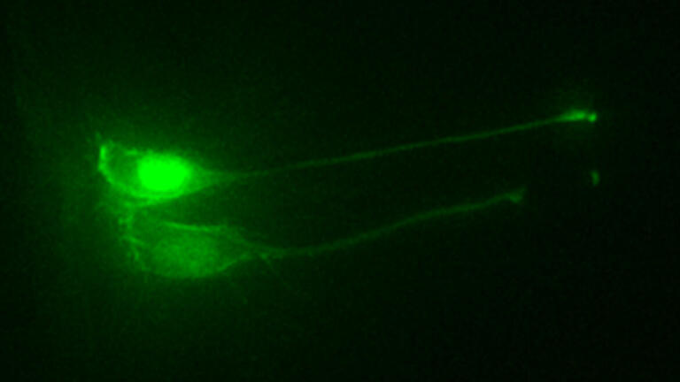 Researchers Uncover Secrets of Newborn Neurons