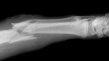 Silk used to create bone-fixing screws