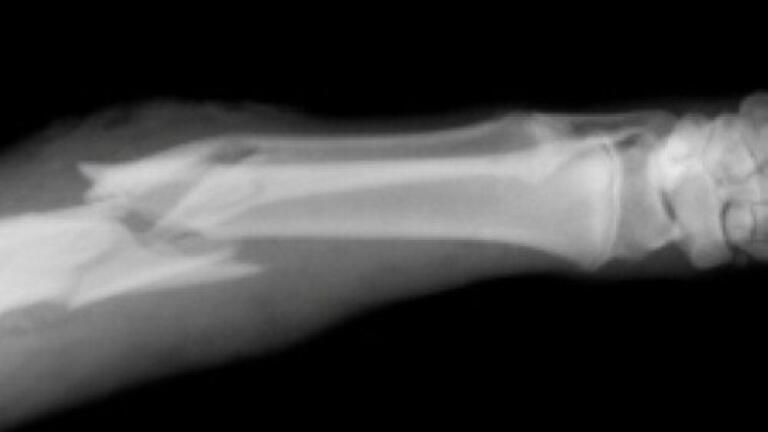 Silk used to create bone-fixing screws