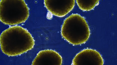 Keep Your Cells Well Rounded with new PrimeSurface™ Culture Ware