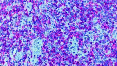 Optical and Electron Microscopy for Forensics