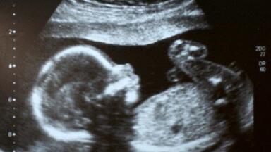 Life stressors trigger neurological disorders in unborns