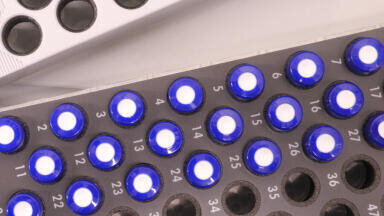 Eliminate tedious Sample Preparation with Laboratory Automation