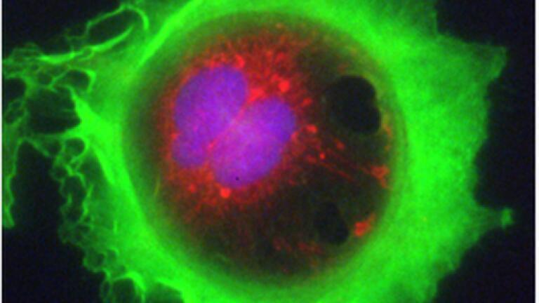 Cell Imaging Competition Provides Spectacular Research Images