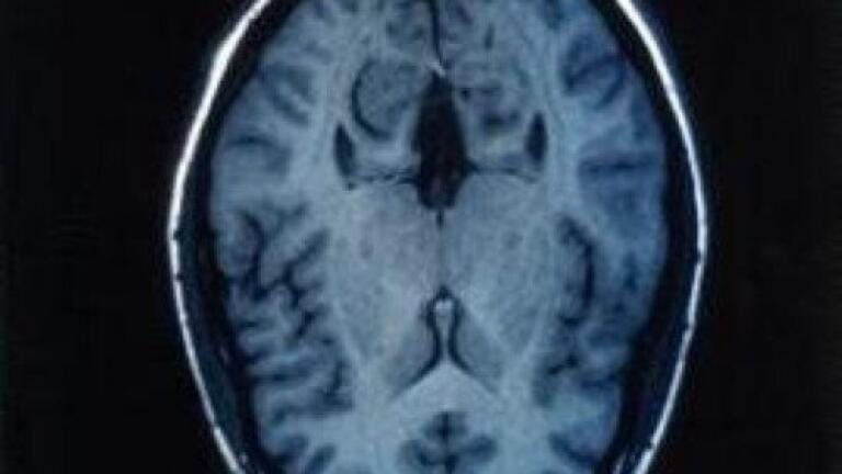 Being bilingual 'slows brain ageing'