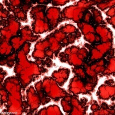 Bacteria could explain why stress triggers heart attacks