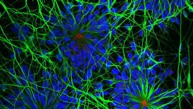 High Quality in vitro Cell Models for Cortical Neurophysiology