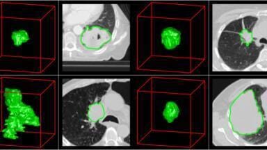 Researchers Use Cost Effective Technology to Unravel Cancer Through Standard Imaging