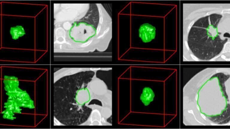 Researchers Use Cost Effective Technology to Unravel Cancer Through Standard Imaging
