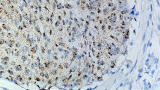 Advanced Cell Diagnostics Receives ISO Certification