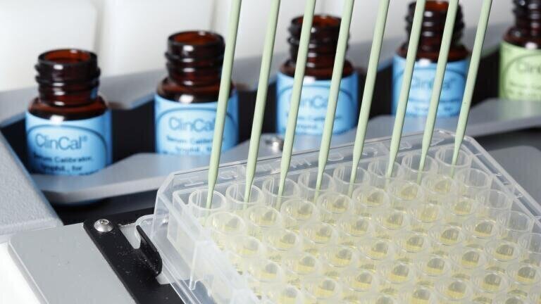 Tecan and Recipe announce Co-marketing Agreement for Automation of LC-MSMS IVD kits