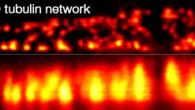 STED Microscopes with below 25 nm Optical Resolution 