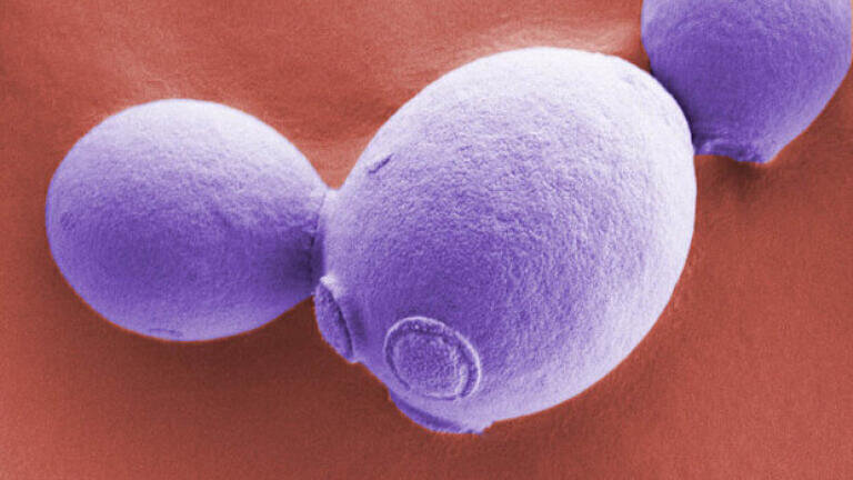 BBSRC competition finalist  