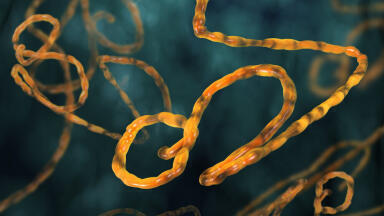 Ebola - What Are the Symptoms?