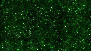 Highly Efficient Neural Transfection Reagent