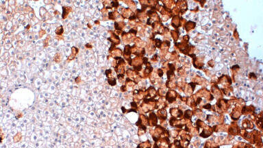 New Hepatitis B Reagents