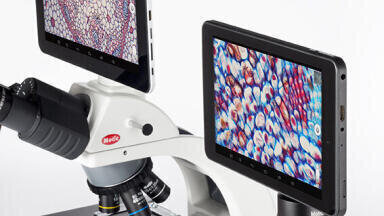 Discover how to Integrate Android Technology in Microscopy