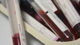 London NHS Trust Adopts NIPT
