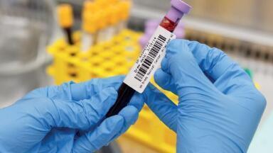 Are your sample identification labels reliable?