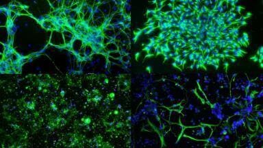 High Efficiency mRNA Delivery??